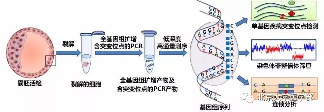 科学｜人工授精和供卵试管婴儿的区别是什么？