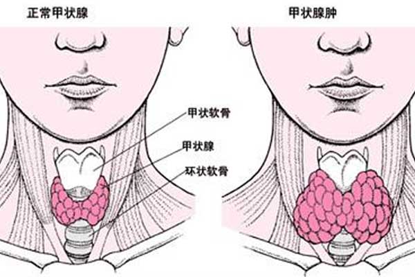 做借卵试管婴儿一代的费用是多少？