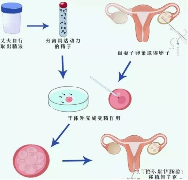 美国做供卵试管代生的意义是什么，成功率有多高？