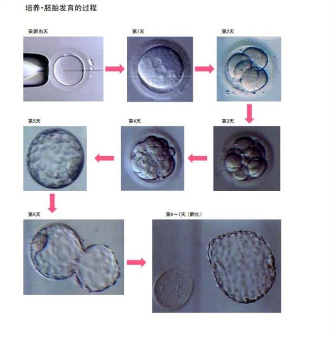 北京航空航天大学附属医院供卵做借卵试管代生之路，首次成功!附宝宝照片