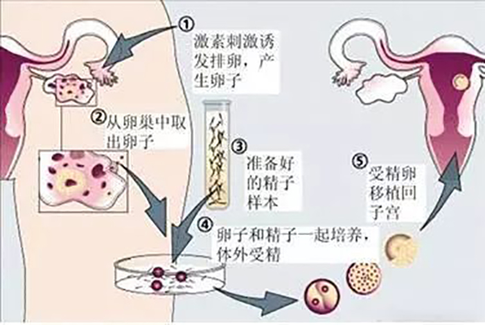 供卵做试管婴儿哪家医院好成功率高