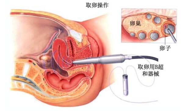 妇产科医生告诉你产后不来月经、闭经怎么回事+怎么办