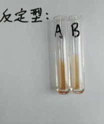 移植失败有什么症状或感觉会阴道出血吗