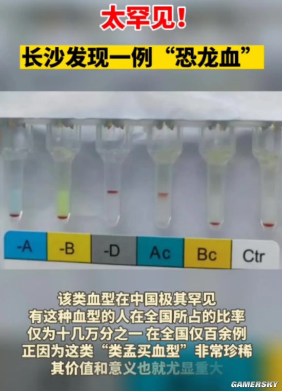 40岁国内供卵试管代怀协会成功率有多大(代生包成功婴儿成功率有多