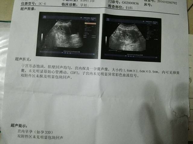 柳州供卵皆去李广零风险+代怀可以生双胞胎吗就去李广