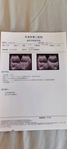 2024年广西柳州妇幼保做环球试管代怀费用大概多少钱