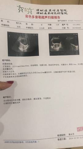 协和医院一代试管费用柳州协和医院一代试管