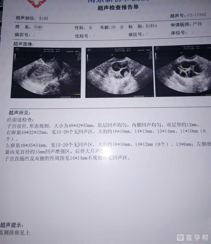 异常卵泡提前破裂须早治疗!4招帮你轻松恢复正常