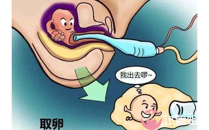 精子库护士李晓蓉