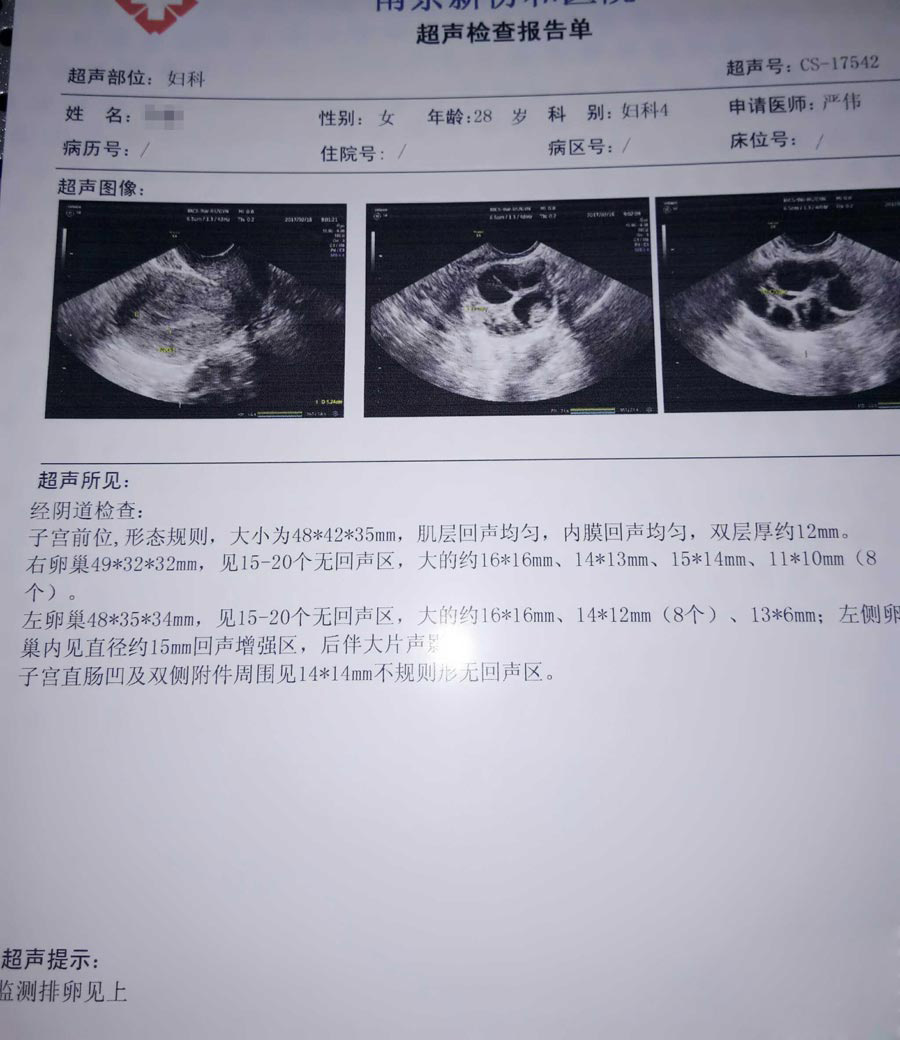 43岁自然周期方案取卵前需要打夜针来提高成功率吗+